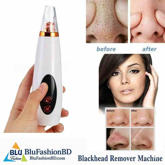 black head remover