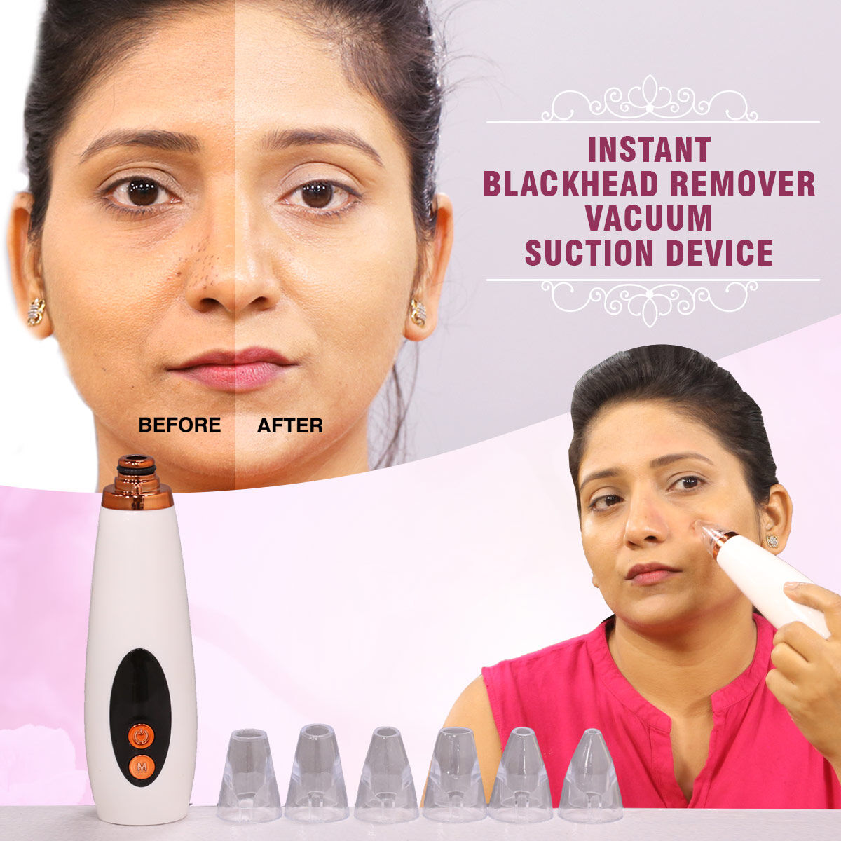 black head remover